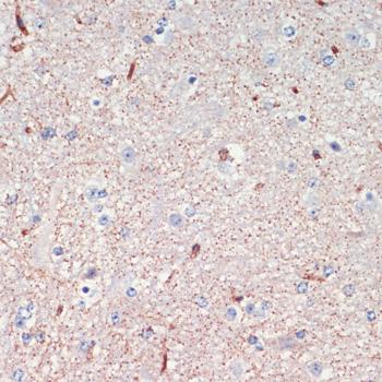 LRRK2 Antibody - Immunohistochemistry of paraffin-embedded Mouse spinal cord using LRRK2 Polyclonal Antibody at dilution of 1:200 (40x lens).