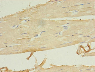 LRRN1 Antibody - Immunohistochemistry of paraffin-embedded human skeletal muscle tissue using LRRN1 Antibody at dilution of 1:100