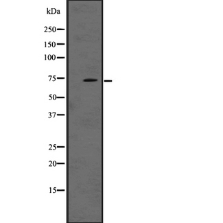 LRRN1 Antibody - Western blot analysis of LRRN1 expression in A431 whole cells lysate. The lane on the left is treated with the antigen-specific peptide.
