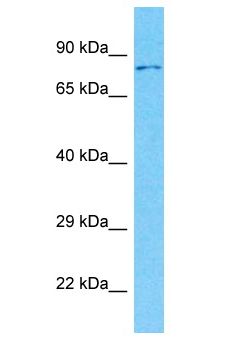 LRRN3 Antibody - LRRN3 antibody Western Blot of MCF7. Antibody dilution: 1 ug/ml.  This image was taken for the unconjugated form of this product. Other forms have not been tested.