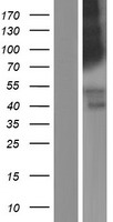 LRRN4 / C20orf75 Protein - Western validation with an anti-DDK antibody * L: Control HEK293 lysate R: Over-expression lysate