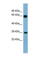 LRRN4CL Antibody - LRRN4CL antibody Western blot of 721_B cell lysate. This image was taken for the unconjugated form of this product. Other forms have not been tested.