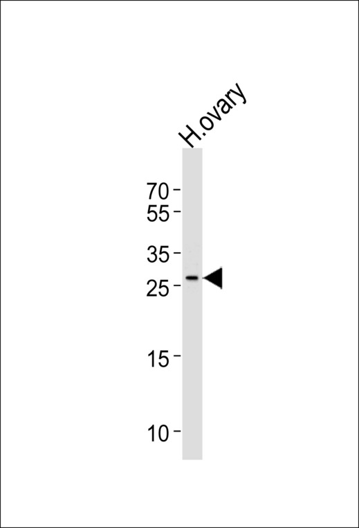 LRRN4CL Antibody - Western blot of lysate from human ovary tissue lysate, using LRRN4CL Antibody. Antibody was diluted at 1:1000 at each lane. A goat anti-rabbit IgG H&L (HRP) at 1:5000 dilution was used as the secondary antibody. Lysate at 35ug per lane.