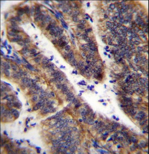 LRRN4CL Antibody - LRRN4CL Antibody immunohistochemistry of formalin-fixed and paraffin-embedded human uterus tissue followed by peroxidase-conjugated secondary antibody and DAB staining.