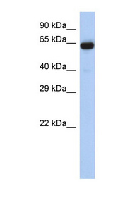 LRRTM1 Antibody - LRRTM1 antibody Western blot of Placenta lysate. This image was taken for the unconjugated form of this product. Other forms have not been tested.