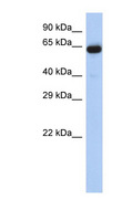 LRRTM1 Antibody - LRRTM1 antibody Western blot of Placenta lysate. This image was taken for the unconjugated form of this product. Other forms have not been tested.
