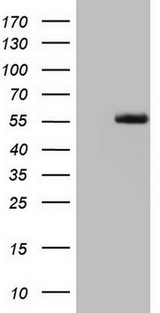 LRRTM1 Antibody - HEK293T cells were transfected with the pCMV6-ENTRY control. (Left lane) or pCMV6-ENTRY LRRTM1. (Right lane) cDNA for 48 hrs and lysed. Equivalent amounts of cell lysates. (5 ug per lane) were separated by SDS-PAGE and immunoblotted with anti-LRRTM1.