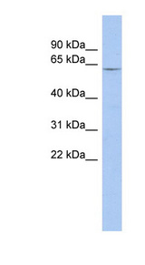 LRRTM1 Antibody - LRRTM1 antibody Western blot of Fetal Muscle lysate. This image was taken for the unconjugated form of this product. Other forms have not been tested.