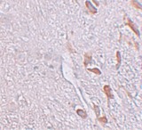 LRRTM1 Antibody - Immunohistochemistry of LRRTM1 in human brain tissue with LRRTM1 antibody at 5 ug/ml.