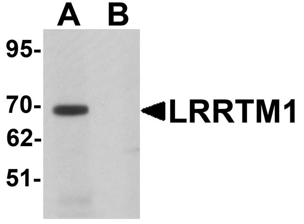 LRRTM1 Antibody - Western blot analysis of LRRTM1 in mouse brain tissue lysate with LRRTM1 antibody at 1 ug/ml in (A) the absence and (B) the presence of blocking peptide.