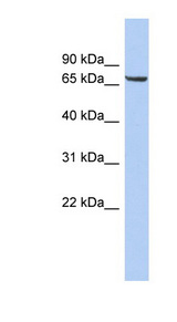 LRRTM4 Antibody - LRRTM4 antibody Western blot of OVCAR-3 cell lysate. This image was taken for the unconjugated form of this product. Other forms have not been tested.