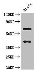 LRRTM4 Antibody - Positive WB detected in:Mouse brain tissue;All lanes: LRRTM4 antibody at 3ug/ml;Secondary;Goat polyclonal to rabbit IgG at 1/50000 dilution;Predicted band size: 68,60 kDa;Observed band size: 68,40 kDa;