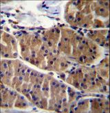 LRSAM1 Antibody - LRSAM1 Antibody immunohistochemistry of formalin-fixed and paraffin-embedded human stomach tissue followed by peroxidase-conjugated secondary antibody and DAB staining.
