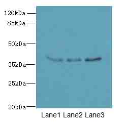 LRTM1 Antibody - Western blot. All lanes: LRTM1 antibody at 0.4 ug/ml. Lane 1: K562 whole cell lysate. Lane 2: HepG-2 whole cell lysate. Lane 3: A431 whole cell lysate. Secondary Goat polyclonal to Rabbit IgG at 1:10000 dilution. Predicted band size: 38 kDa. Observed band size: 38 kDa.