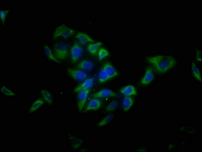 LRTM1 Antibody - Immunofluorescence staining of Hela cells with LRTM1 Antibody at 1:13, counter-stained with DAPI. The cells were fixed in 4% formaldehyde, permeabilized using 0.2% Triton X-100 and blocked in 10% normal Goat Serum. The cells were then incubated with the antibody overnight at 4°C. The secondary antibody was Alexa Fluor 488-congugated AffiniPure Goat Anti-Rabbit IgG(H+L).