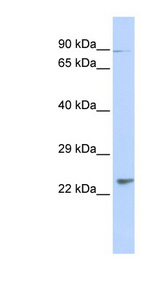 LRTOMT Antibody - LRTOMT / LRRC51 antibody Western blot of Fetal Heart lysate. This image was taken for the unconjugated form of this product. Other forms have not been tested.