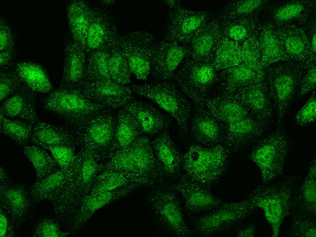 LRWD1 Antibody - Immunofluorescence staining of LRWD1 in U2OS cells. Cells were fixed with 4% PFA, permeabilzed with 0.1% Triton X-100 in PBS, blocked with 10% serum, and incubated with rabbit anti-Human LRWD1 polyclonal antibody (dilution ratio 1:200) at 4°C overnight. Then cells were stained with the Alexa Fluor 488-conjugated Goat Anti-rabbit IgG secondary antibody (green). Positive staining was localized to Nucleus and Cytoplasm.