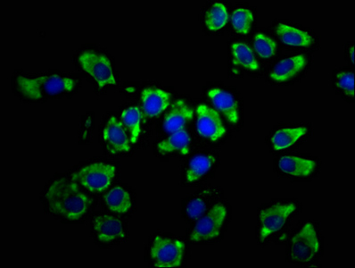 LSAMP / LAMP Antibody - Immunofluorescence staining of A549 cells at a dilution of 1:66, counter-stained with DAPI. The cells were fixed in 4% formaldehyde, permeabilized using 0.2% Triton X-100 and blocked in 10% normal Goat Serum. The cells were then incubated with the antibody overnight at 4 °C.The secondary antibody was Alexa Fluor 488-congugated AffiniPure Goat Anti-Rabbit IgG (H+L) .