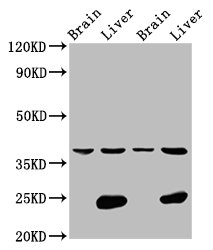 LSAMP / LAMP Antibody - Positive Western Blot detected in Rat brain tissue, Rat liver tissue, Mouse brain tissue, Mouse liver tissue. All lanes: LSAMP antibody at 4.2 µg/ml Secondary Goat polyclonal to rabbit IgG at 1/50000 dilution. Predicted band size: 38 KDa. Observed band size: 38 KDa