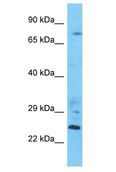 LSG1 Antibody - LSG1 antibody Western Blot of ACHN. Antibody dilution: 1 ug/ml.  This image was taken for the unconjugated form of this product. Other forms have not been tested.