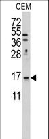 LSM1 Antibody - Western blot of anti-LSM1 Antibody in HeLa cell line lysates (35 ug/lane). LSM1 (arrow) was detected using the purified antibody.