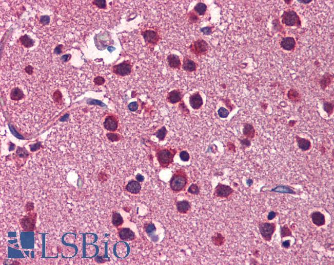 LSM1 Antibody - Anti-LSM1 antibody IHC of human brain, cortex. Immunohistochemistry of formalin-fixed, paraffin-embedded tissue after heat-induced antigen retrieval. Antibody concentration 5 ug/ml.  This image was taken for the unconjugated form of this product. Other forms have not been tested.