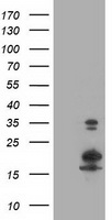 LSM1 Antibody - HEK293T cells were transfected with the pCMV6-ENTRY control (Left lane) or pCMV6-ENTRY LSM1 (Right lane) cDNA for 48 hrs and lysed. Equivalent amounts of cell lysates (5 ug per lane) were separated by SDS-PAGE and immunoblotted with anti-LSM1.