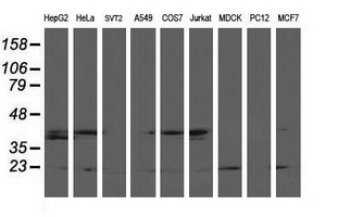 LSM1 Antibody - Western blot of extracts (35 ug) from 9 different cell lines by using anti-LSM1 monoclonal antibody.