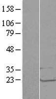 LSM1 Protein - Western validation with an anti-DDK antibody * L: Control HEK293 lysate R: Over-expression lysate