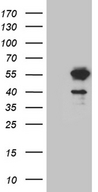 LSM11 Antibody - HEK293T cells were transfected with the pCMV6-ENTRY control. (Left lane) or pCMV6-ENTRY LSM11. (Right lane) cDNA for 48 hrs and lysed. Equivalent amounts of cell lysates. (5 ug per lane) were separated by SDS-PAGE and immunoblotted with anti-LSM11. (1:2000)