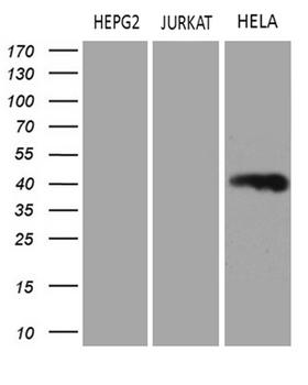 LSM11 Antibody - Western blot analysis of extracts. (35ug) from 3 different cell lines by using anti-LSM11 monoclonal antibody. (1:500)
