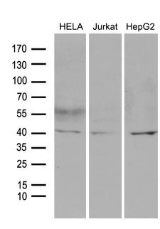 LSM11 Antibody - Western blot analysis of extracts. (35ug) from 3 different cell lines by using anti-LSM11 monoclonal antibody. (1:500)