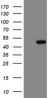 LSM11 Antibody - HEK293T cells were transfected with the pCMV6-ENTRY control. (Left lane) or pCMV6-ENTRY LSM11. (Right lane) cDNA for 48 hrs and lysed