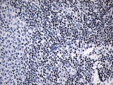 LSM11 Antibody - Immunohistochemical staining of paraffin-embedded Human tonsil within the normal limits using anti-LSM11 mouse monoclonal antibody. (Heat-induced epitope retrieval by 1mM EDTA in 10mM Tris buffer. (pH8.5) at 120°C for 3 min. (1:150)