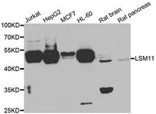 LSM11 Antibody - Western blot analysis of extracts of various cell lines.