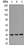 LSM11 Antibody - Western blot analysis of LSm11 expression in HepG2 (A); MCF7 (B); rat brain (C) whole cell lysates.