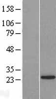 LSM12 Protein - Western validation with an anti-DDK antibody * L: Control HEK293 lysate R: Over-expression lysate