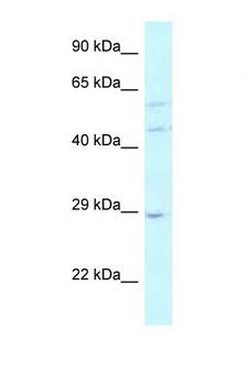 LSM14A Antibody - LSM14A antibody Western blot of 721_B Cell lysate. Antibody concentration 1 ug/ml. This image was taken for the unconjugated form of this product. Other forms have not been tested.