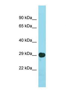 LSM14B Antibody - Western blot of Human Fetal Brain. LSM14B antibody dilution 1.0 ug/ml.  This image was taken for the unconjugated form of this product. Other forms have not been tested.