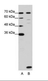 LSM2 / SnRNP Antibody - A: Marker, B: HepG2 Cell Lysate.  This image was taken for the unconjugated form of this product. Other forms have not been tested.