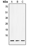LSM2 / SnRNP Antibody - Western blot analysis of LSM2 expression in HEK293T (A); NIH3T3 (B); PC12 (C) whole cell lysates.