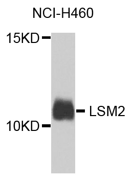 LSM2 / SnRNP Antibody - Western blot analysis of extracts of NCL-H460 cells.