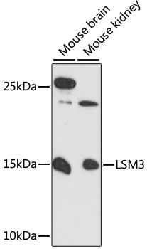 LSM3 Antibody - Western blot analysis of extracts of various cell lines, using LSM3 antibody at 1:3000 dilution. The secondary antibody used was an HRP Goat Anti-Rabbit IgG (H+L) at 1:10000 dilution. Lysates were loaded 25ug per lane and 3% nonfat dry milk in TBST was used for blocking. An ECL Kit was used for detection and the exposure time was 90s.