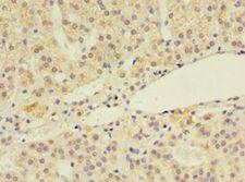 LSM4 Antibody - Immunohistochemistry of paraffin-embedded human adrenal gland using antibody at 1:100 dilution.  This image was taken for the unconjugated form of this product. Other forms have not been tested.