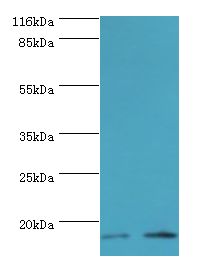 LSM4 Antibody - Western blot. All lanes: LSM4 antibody at 2 ug/ml. Lane 1: A549 whole cell lysate Lane 2: K562 whole cell lysate. Secondary antibody: goat polyclonal to rabbit at 1:10000 dilution. Predicted band size: 15 kDa. Observed band size: 15 kDa.  This image was taken for the unconjugated form of this product. Other forms have not been tested.