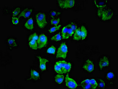 LSM4 Antibody - Immunofluorescent analysis of MCF-7 cells using LSM4 Antibody at dilution of 1:100 and Alexa Fluor 488-congugated AffiniPure Goat Anti-Rabbit IgG(H+L)