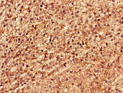 LSM4 Antibody - Immunohistochemistry of paraffin-embedded human adrenal gland tissue using LSM4 Antibody at dilution of 1:100