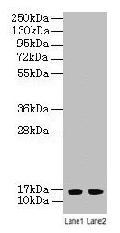 LSM4 Antibody - Western blot All lanes: LSM4 antibody at 2µg/ml Lane 1: A549 whole cell lysate Lane 2: K562 whole cell lysate Secondary Goat polyclonal to rabbit IgG at 1/10000 dilution Predicted band size: 15 kDa Observed band size: 15 kDa