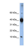 LSM4 Antibody - LSM4 antibody Western blot of Jurkat lysate. This image was taken for the unconjugated form of this product. Other forms have not been tested.