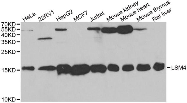 LSM4 Antibody - Western blot analysis of extracts of various cell lines.